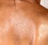 Understanding Melanotan-2 (MT-2) in Peptide Research